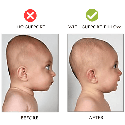 Baby head and neck support pillow lifestyle